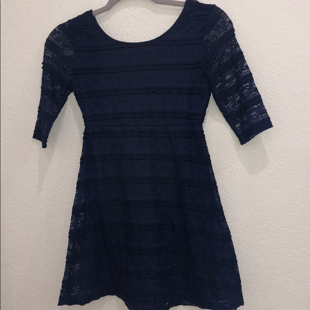 Lace Dress! 👗